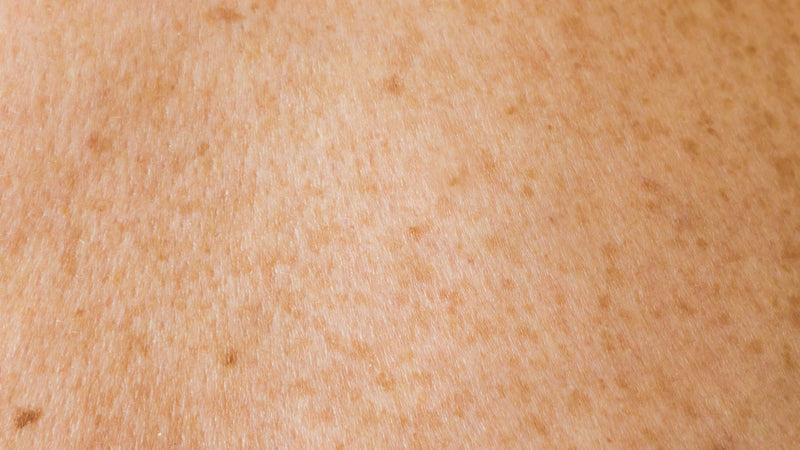 Detalle de piel humana, referencia de piel sensible