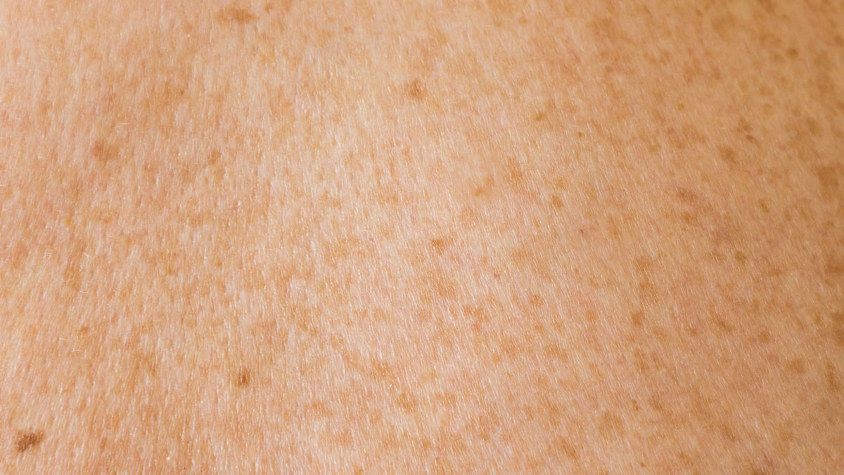 Detalle de piel humana, referencia de piel sensible